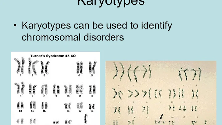 Karyotypes and Nondisjunction