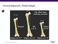 Primary knee replacement  abos orthopedic surgery board exam review
