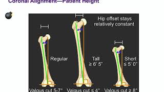 Primary Knee Replacement  ABOS Orthopedic Surgery Board Exam Review