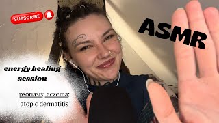 ASMR| energy healing to help remove your psoriasis/eczema/atopic dermatitis/etc… ✨