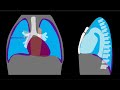 Pneumothorax Explained by Prometheus Lionhart, MD