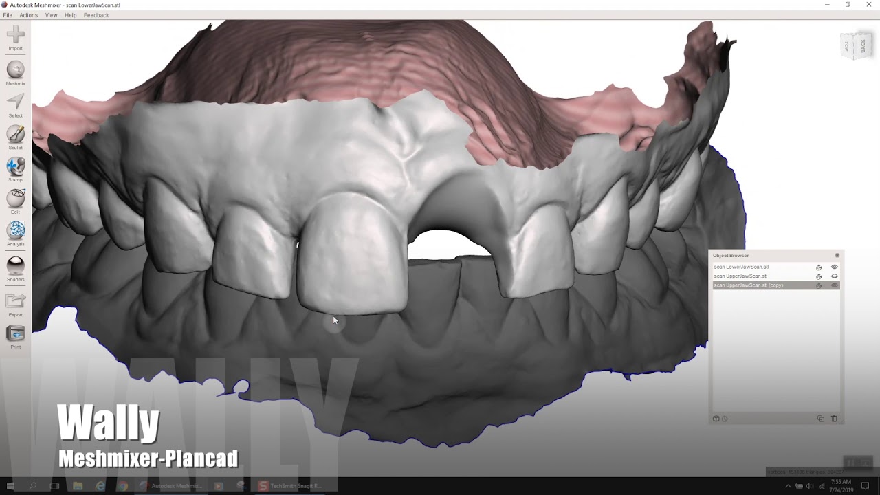 Extract tooth meshmixer and import for waxing in Romexis