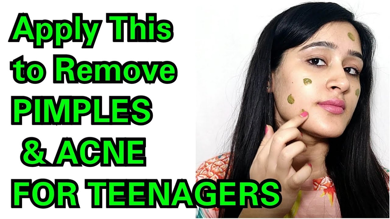 TEENAGERS SPECIAL PIMPLE + ACNE REMOVAL - QUICK AND EASY - YouTube