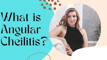 What is Angular Cheilitis?