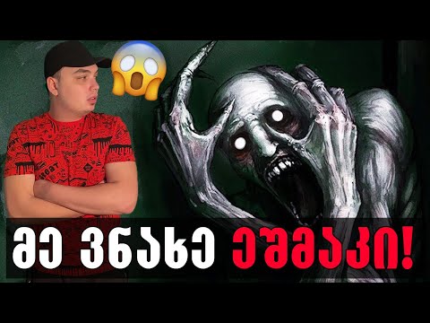 ამ დაავადებამ მანახა ეშმაკი,მაგრამ მე ის დავამარცხე!