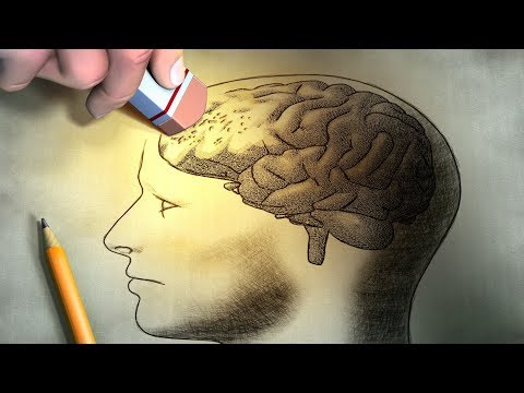 Video: Kannst Du Lernen Zu Vergessen? - Alternative Ansicht
