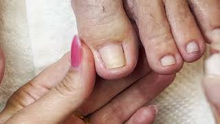 Relaxing Big Toes Toenail Cleaning