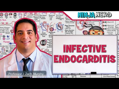 Infective Endocarditis