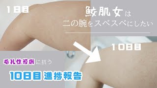 【二の腕ブツブツ】明るくなった！１０日目進捗報告-自力で改善する毛孔性苔癬【１０日目】