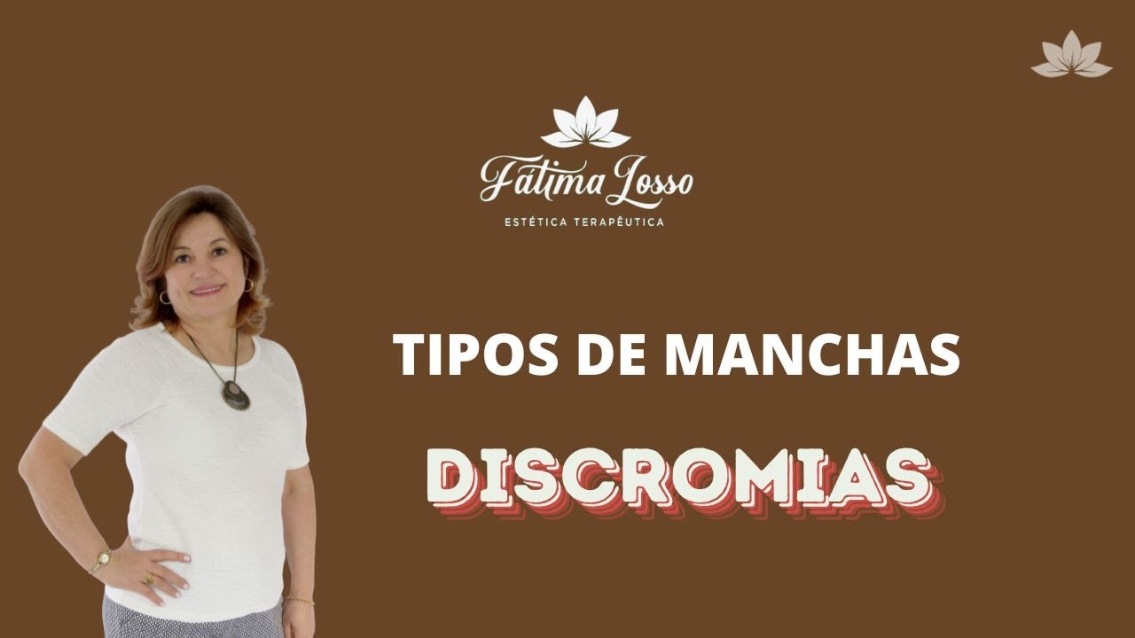TIPOS DE MANCHAS - DISCROMIAS