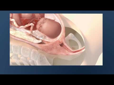 Video: How Does Childbirth Take Place?