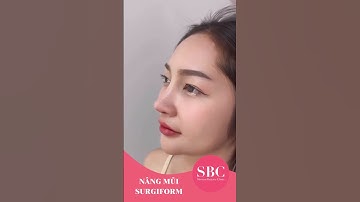 Cải thiện khuyết điểm mũi sau 60 phút