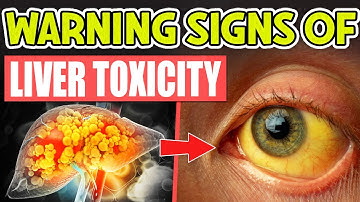 15 Weird Signs Your Liver is Begging For Detox