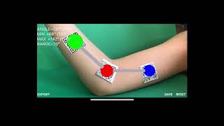 How to measure with Dynamic Goniometer AR App-itunes
