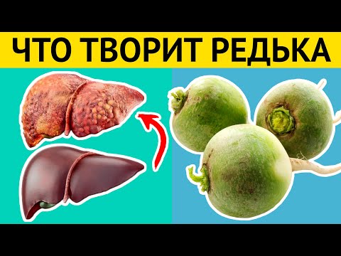 Video: Ташкент лимону: сорттун сүрөттөлүшү, өстүрүү өзгөчөлүктөрү