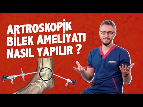 ARTROSKOPİK BİLEK AMELİYATI NASIL YAPILIR ? İYİLEŞME SÜRECİ NASIL | OP. DR. FATİH KEMAL DOĞAN