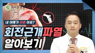 고장난 내 어깨...  '회전근개파열'  무조건 수술해야 할까요?