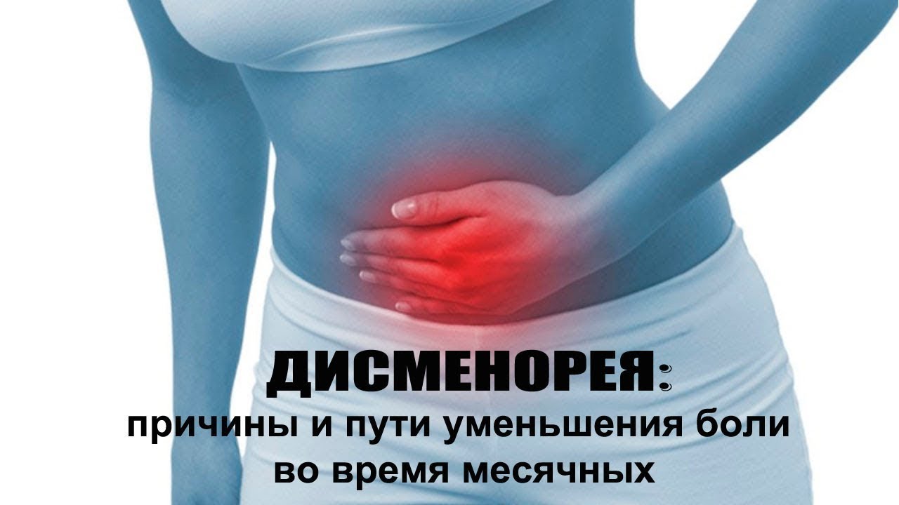 АЛЬГОМЕНОРЕЯ (дисменорея) - болезненные месячные, причины и что делать ...