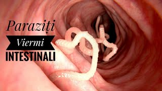 Parazitozele intestinale: giardioza si ascaridioza | etigararunway.ro