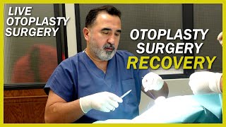 Otoplasty Surgery Recovery #otoplastia