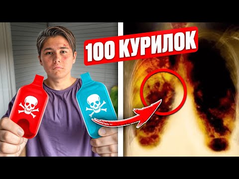 ДОПАРИЛСЯ! ШКОЛЬНИК ДУНУЛ 100 ДУДОК и ОТРАВИЛСЯ! ЯД ☠️