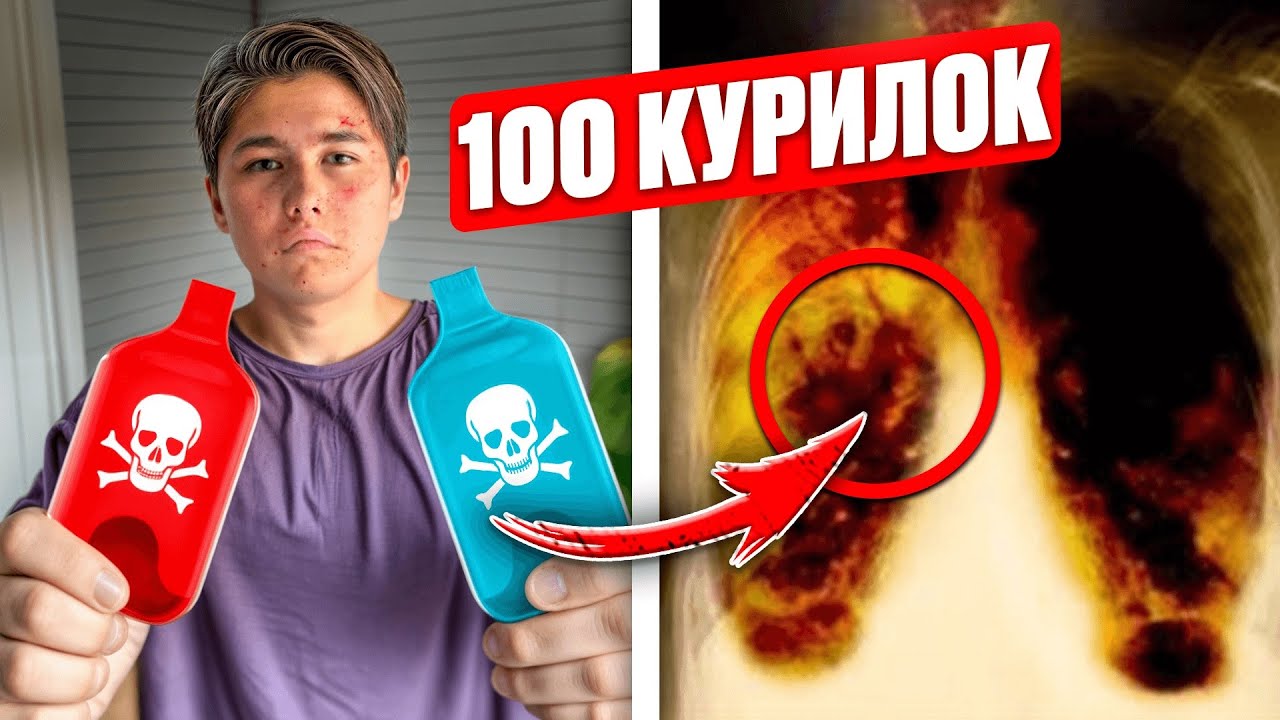 ДОПАРИЛСЯ! ШКОЛЬНИК ДУНУЛ 100 ДУДОК и ОТРАВИЛСЯ! ЯД ☠️