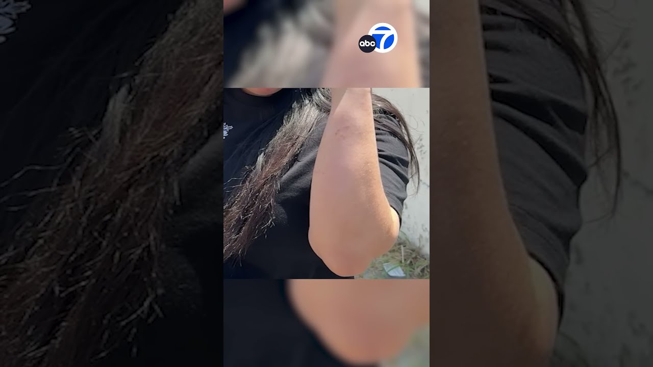Torrance Mom Chases Burglary Suspects Who Broke Into Her Apartment