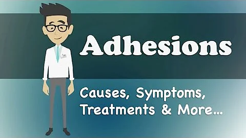 Do adhesions go away on their own?