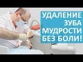 👉 Как проходит удаление зуба мудрости и восстановление после. Удаление зуба мудрости. 12+