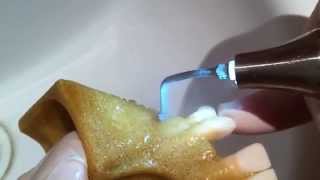 Klinisches Protokoll: Piezocision-Spitze PZ2R