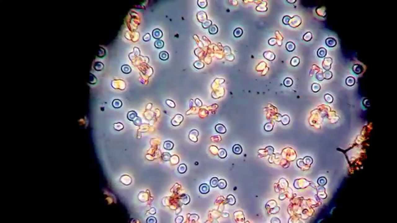 Bloedgroep agglutinatie(klontering rode bloedcellen) microscopisch fasecontrast YouTube Bloedgroep agglutinatie(klontering rode bloedcellen) microscopisch fasecontrast YouTube