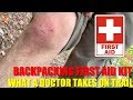 Backpacking First Aid Kit - What a Doctor Takes on the Trail