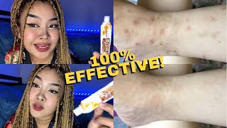 PAANO TANGGALIN ANG PEKLAT? 100% EFFECTIVE NA PANG TANGGAL NG PEKLAT, ALLERGIES etc. Skin Problems |