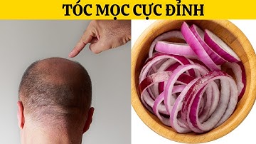 Nước ép hành tây giúp tóc mọc nhanh: Khoa học hay lời đồn?
