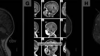 İnsan Beyninin Yüzde Kaçını Kullanıyor?