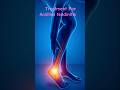 Best Treatment for Achilles Tendinitis | Heel Pain Relief Exercises &amp; Physiotherapy Guide