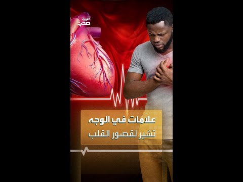 علامات في الوجه تشير لقصور القلب