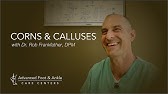 How to Get Rid of Corns on Toes Fast - YouTube
