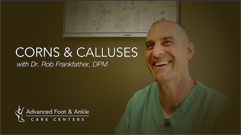 Corns & Calluses - Symptoms & How To Get Rid Of Them