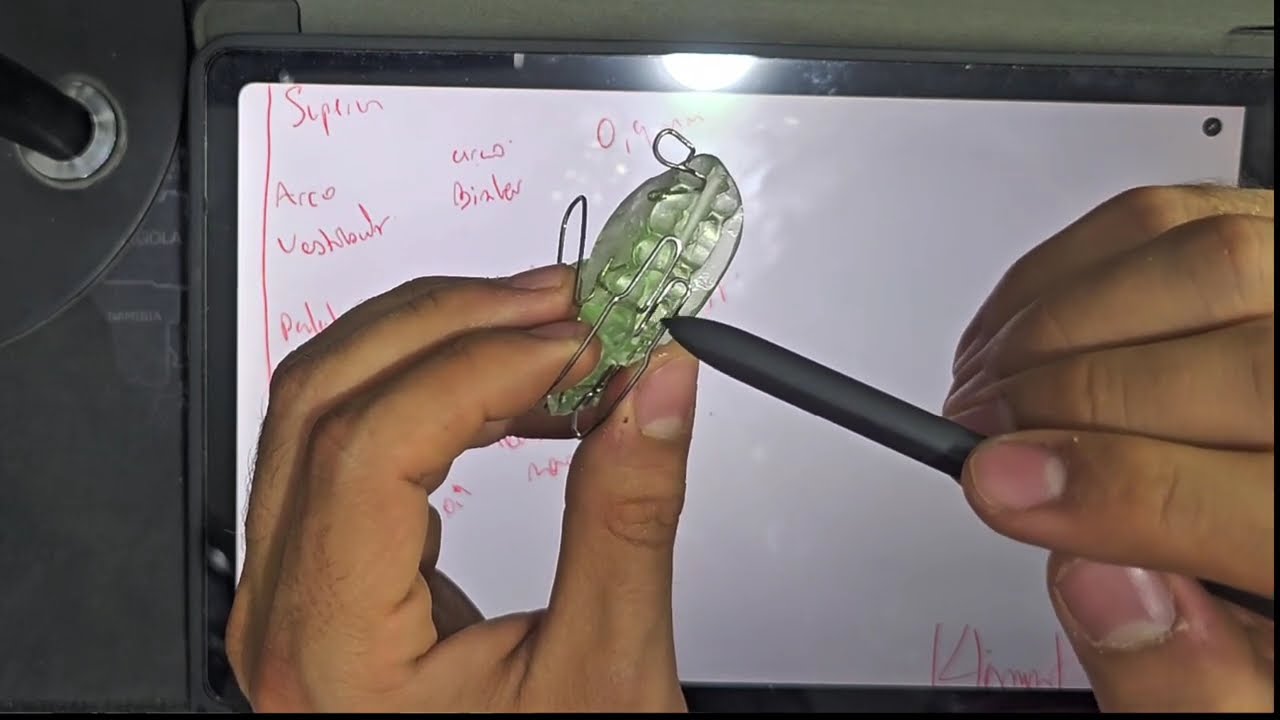 KLAMMT ESTANDAR- ORTOPEDIA MAXILAR