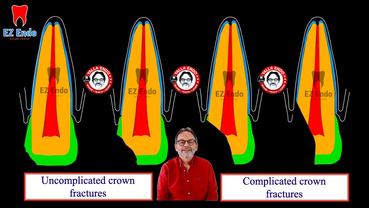 لماذا يجب ان نعرف كيف نتعامل مع حالاتوصدمات الأسنان Why we need to know about Traumatic Injuries