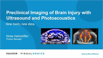 Preclinical Imaging of Brain Injury with Ultrasound and Photoacoustics - New tools; new data