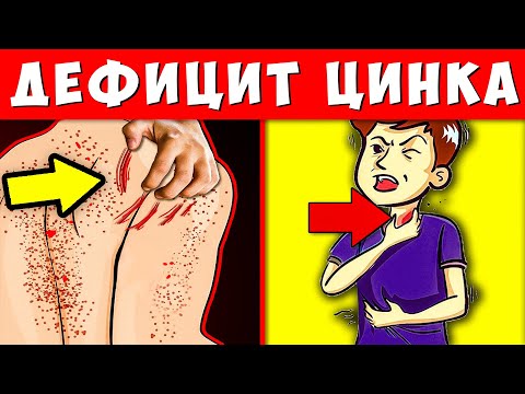 11 Тревожных Сигналов Дефицита Цинка в организме! Вот, чем Восполнить недостаток Цинка