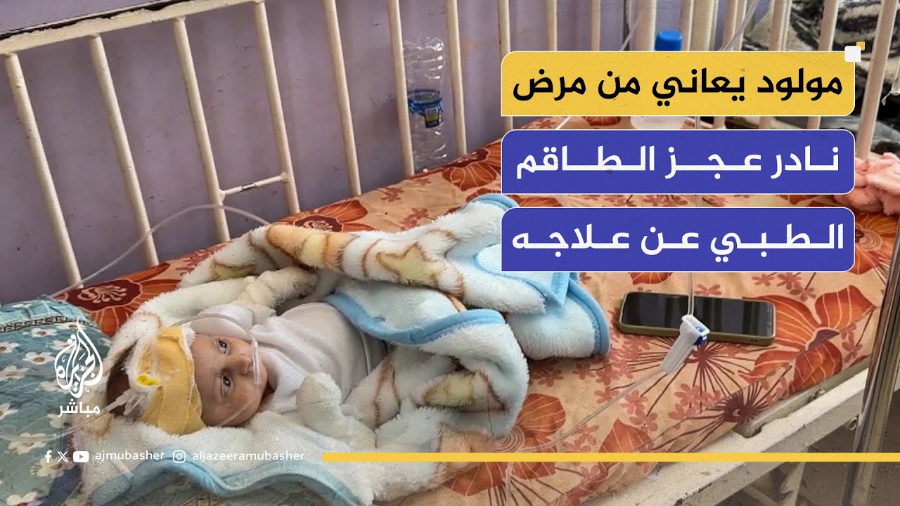 طفل يعاني منذ لحظة ولادته من مرض نادر عجز الطاقم الطبي عن علاجه