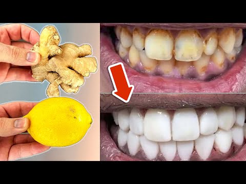 Vídeo: Desapareixen les dents?
