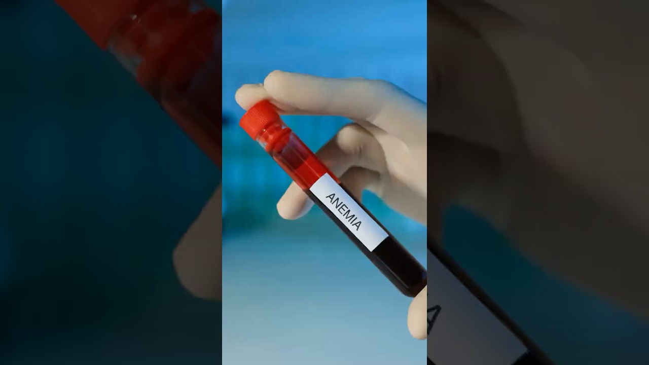 Anemia in Kidney Disease: More Than Just Fatigue