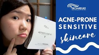 Best Skincare for Acne-Prone, Senstive Skin | Troiareuke