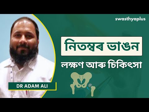 হিপ ফ্ৰেক্টৰ: লক্ষণ আৰু চিকিৎসা | Hip Fracture in Assamese | Causes & Treatment | Dr Adam Ali