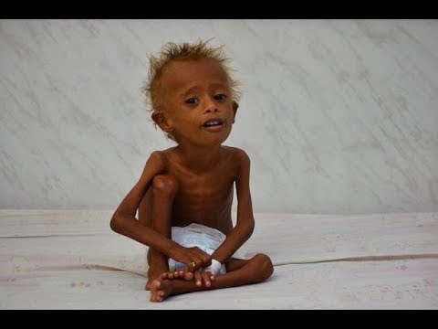 Abayobozi bo muri AFRICA nibo bateza ibibazo by' ubukene byose