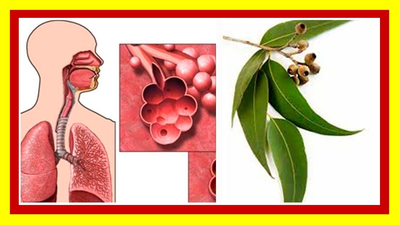 Propiedades Curativas del Eucalipto Como Usar el Eucalipto para